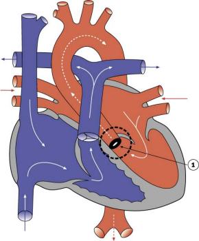 Aorta Diagram