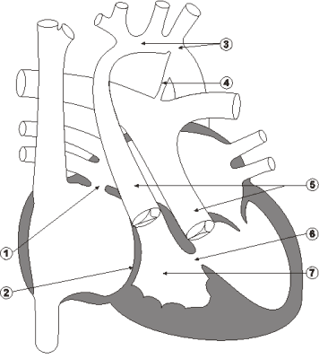 Diagram 6.8 Daniel Terziski - pre-operative heart